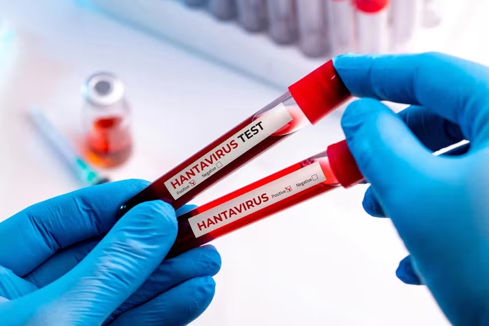 Primeira morte por hantavirus no Brasil é confirmada em Minas Gerais